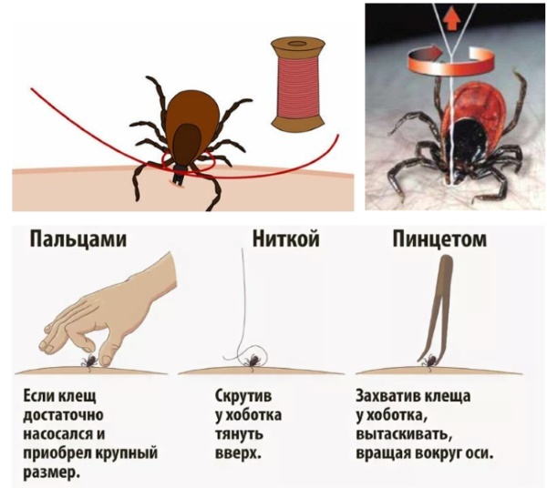 самостоятельно удалить клеща